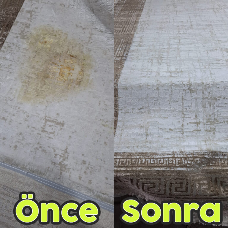 önce sonra 2